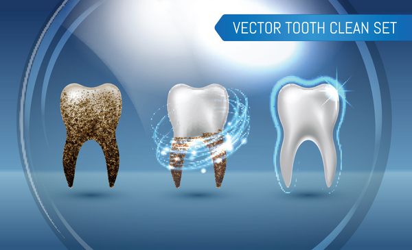 وکتور مجموعه ای از 3D تمیز و کثیف دندان واقع گرایانه روی زمینه آبی پاک کردن فرایند دندان سفید کردن دندان ها مفهوم بهداشت دندانپزشکی مراقبت از دهان ترمیم دندان