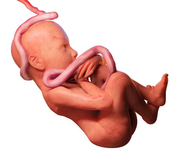 جنین انسان با بند ناف در اطراف گردن جدا شده در پس زمینه سفید رندر سه بعدی