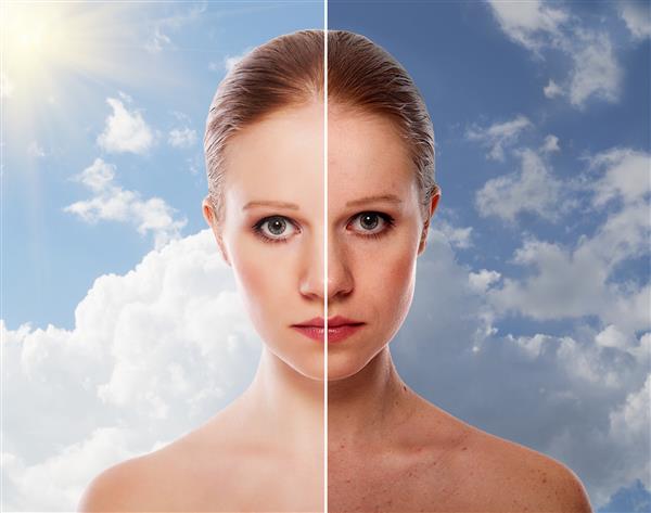 اثر بهبود پوست زیبایی زن جوان قبل و بعد از عمل