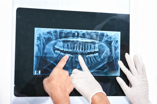 دندانپزشک با معاینه دست و دندان بیمار