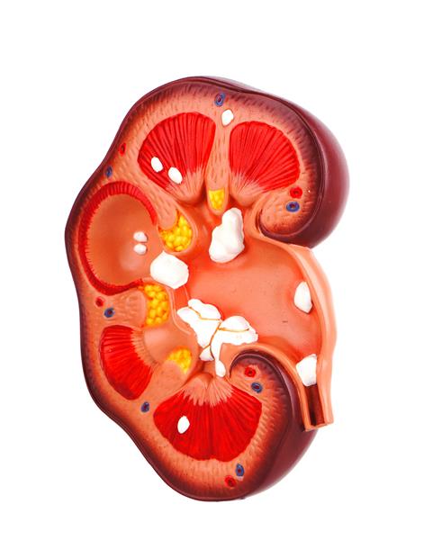 مدل پزشکی کلیه انسان با مقطعی از اندام داخلی با عروق قرمز و آبی و غده فوق کلیه به عنوان یک مراقبت بهداشتی و پزشکی از آناتومی سیستم ادراری