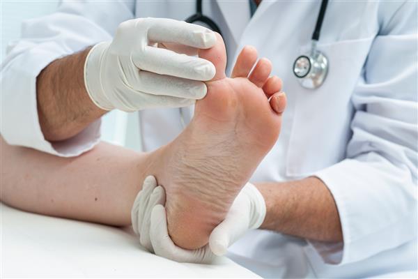 پزشک متخصص پوست پا را در حضور پای ورزشکار بررسی می کند