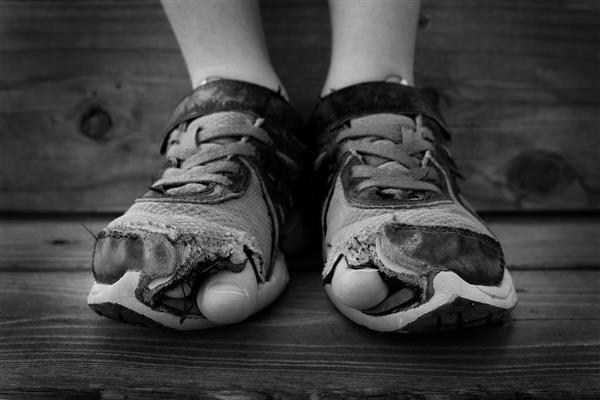 عکس سیاه و سفید کفش هایی که سوراخ های آن و انگشتان پا است و بچه کودک خردسال را بیرون می کشد