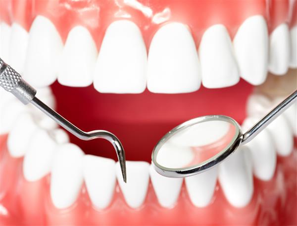 دندانهای سالم و آینه دندانپزشک