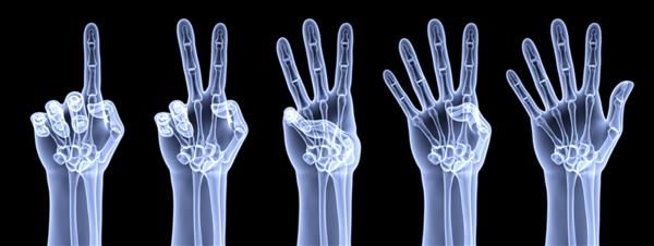 دست انسان تعداد انگشتان زیر اشعه X را نشان می دهد