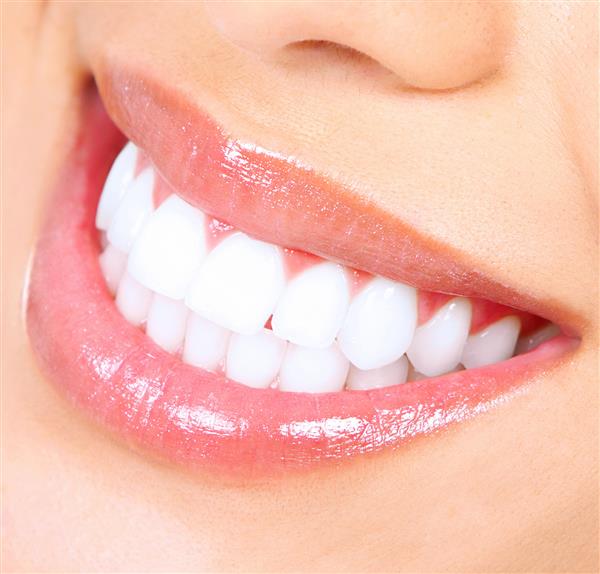 لبخند زن سفید کردن دندان ها مراقبت از دندان