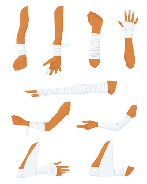 مجموعه ای از دست های پانسمان شده در موقعیت های مختلف فرآیند بانداژ باندهای پزشکی شکستگی و بریدگی در دست دست در باند وکتور تخت جدا شده در پس زمینه سفید