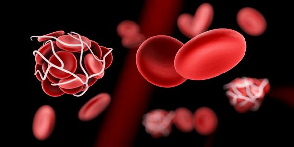 مفهوم تصویر سه بعدی پزشکی لخته خون و ترومبوز