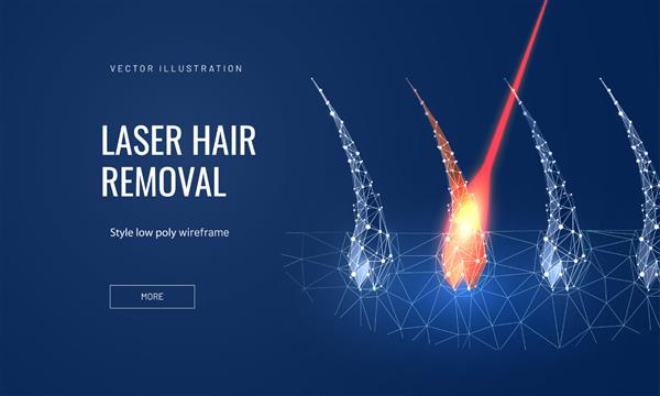 مفهوم لیزر موهای زائد به سبک آینده نگر چند ضلعی برای صفحه فرود تصویر وکتور از فولیکول مو با لیزر برای نشان دادن روند برداشتن روی پس‌زمینه آبی