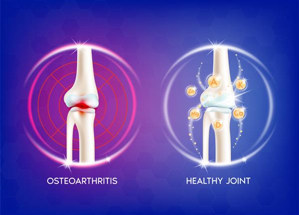آرتریت مفصل زانو درد در ساق پا آناتومی استخوان انسان مفهوم اسکن اشعه ایکس اسکلت و ویتامین درمانی تصویر وکتور EPS10