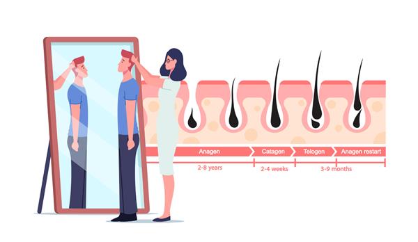شخصیت های پزشک زن و بیمار مرد در اینفوگرافیک های آینه و پزشکی که نشان دهنده چرخه های رشد و ریزش مو هستند آناژن کاتاژن تلوژن و آناژن راه اندازی مجدد تصویر وکتور مردم کارتونی