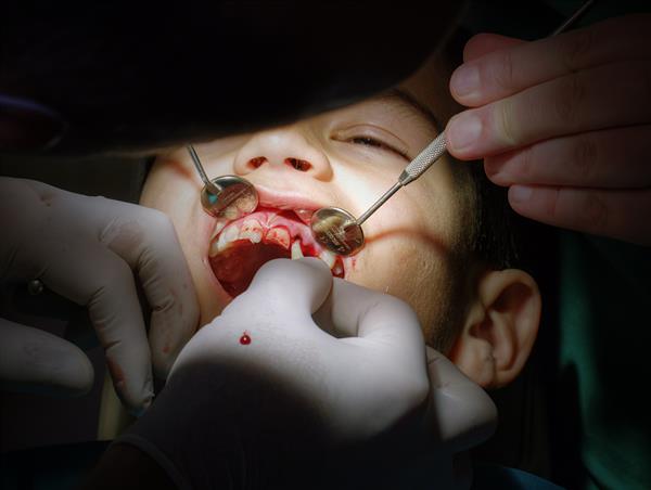 کودک در دندانپزشکی