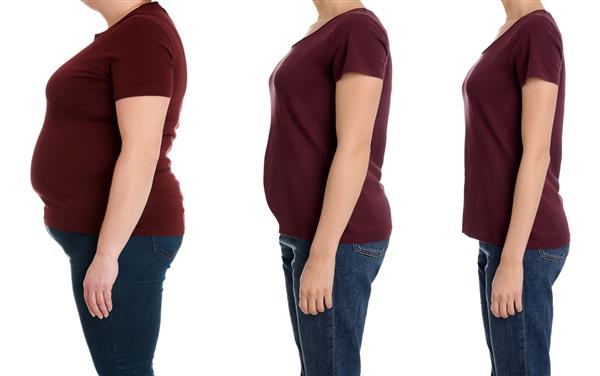 زن دارای اضافه وزن قبل و بعد از کاهش وزن در زمینه سفید نمای نزدیک