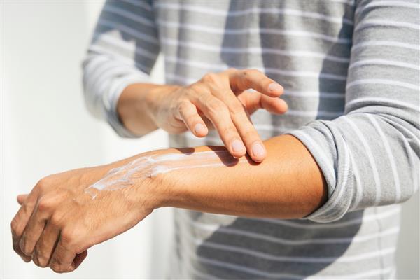 دست مردی که از لوسیون کرم روی بازوها استفاده می کند تا از پوست در برابر اشعه UV خورشید محافظت کند حفاظت خورشیدی بطری لوسیون ضد آفتاب محافظ ضد آفتاب روی دست مرد