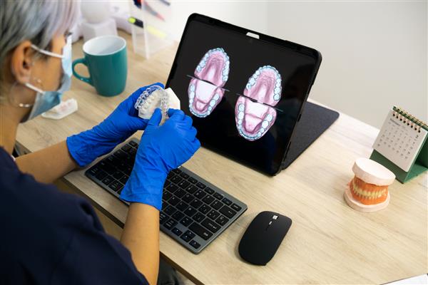 تکنسین دندانپزشکی در حال طراحی پروتز دندان جدید بر روی کامپیوتر در آزمایشگاه خود