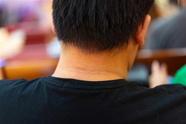 عکس آدم چاق و لاغر