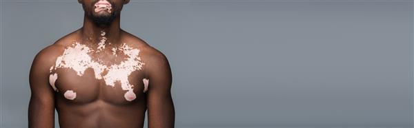 نمای بریده مرد آمریکایی آفریقایی بدون پیراهن با پوست ویتیلیگو و نیم تنه عضلانی جدا شده روی خاکستری بنر