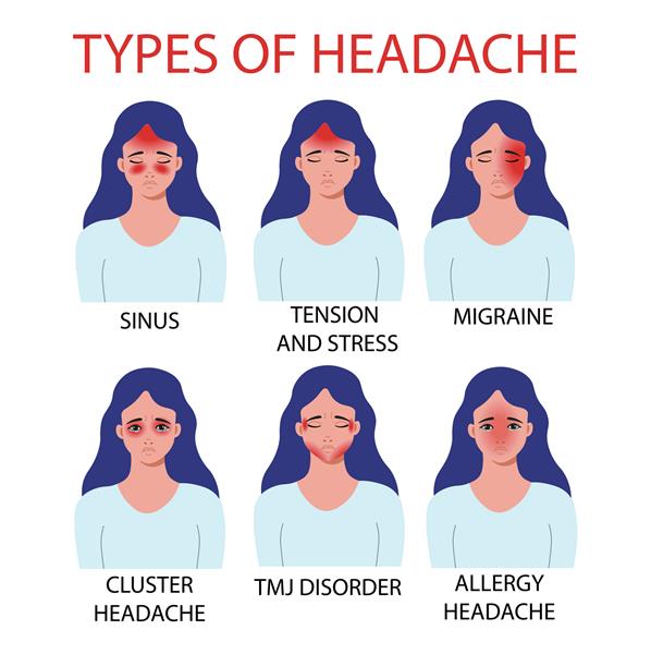 انواع سردرد آلرژی درد مفاصل گیجگاهی فکی سردرد خوشه ای میگرن سینوس تنش و استرس تصویر برداری