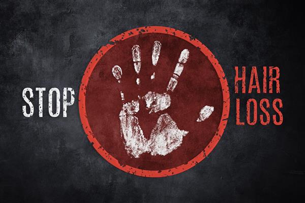 پوستر دیواری کلینیک زیبایی کاشت مو و ترمیم مو