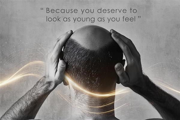 پوستر دیواری سه بعدی تخصصی کاشت مو با تم رنگی سیاه سفید